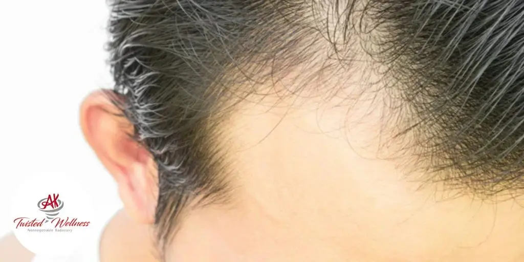 DECODING DIHYDROTESTOSTERONE (DHT): UNDERSTANDING ITS ROLE IN HEALTH AND HAIR LOSS