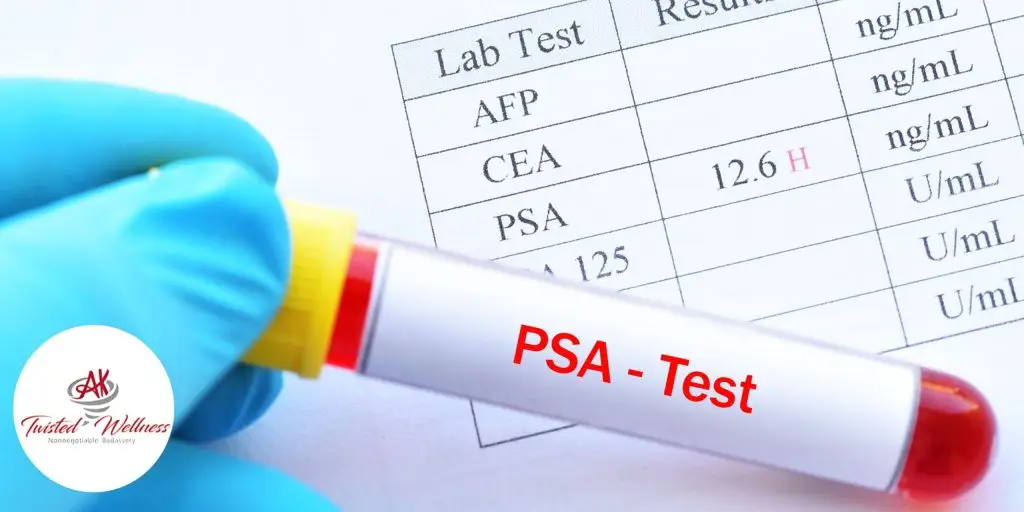 PSA Test