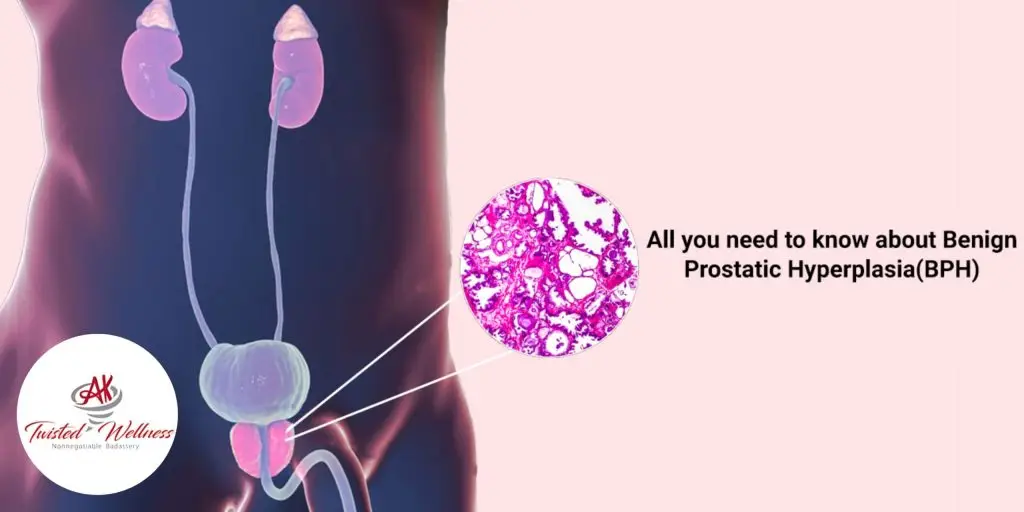 Benign Prostatic Hyperplasia