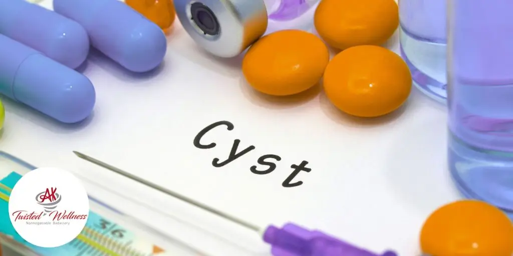 Epididymal Cysts