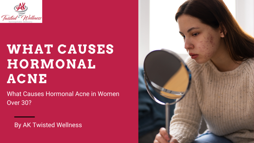 hormonal acne in women over 30