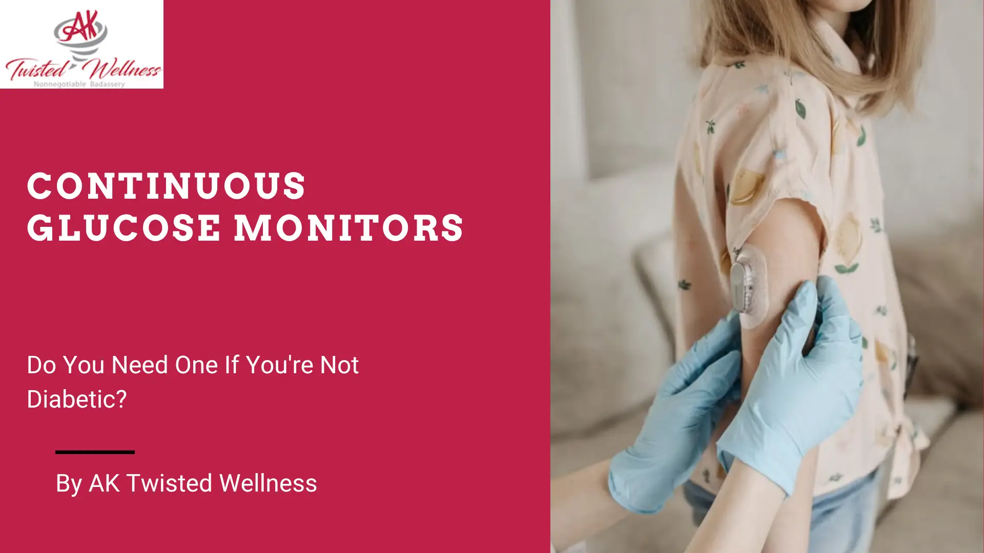 Continuous Glucose Monitors